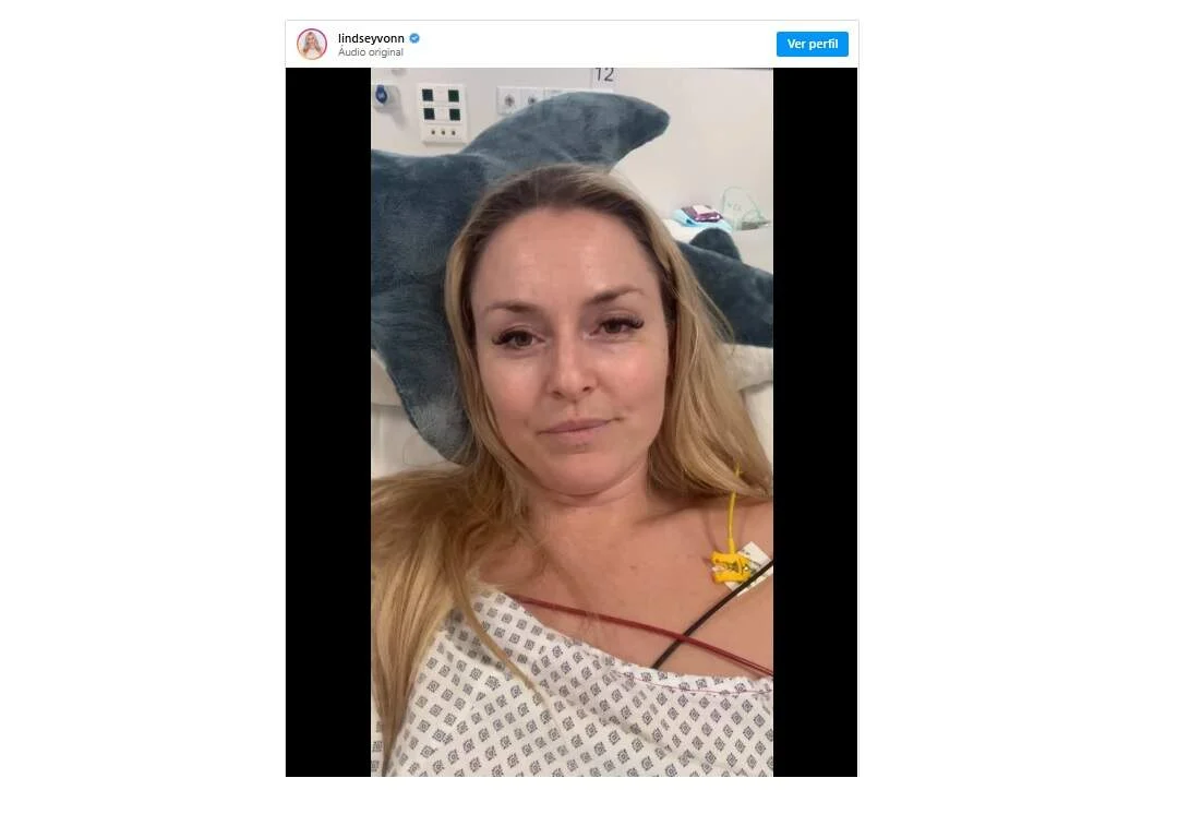 Lindsey Vonn enfrenta quarta cirurgia após grave acidente nos Jogos de Inverno