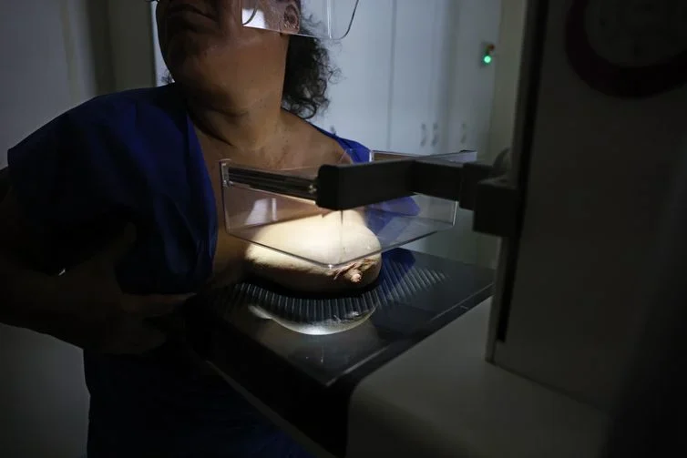 Ministério da Saúde revela aumento de mamografias e alerta sobre câncer de mama