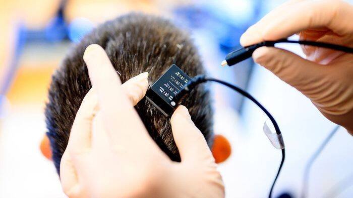 China libera primeiro BCI comercial que promete devolver movimentos a tetraplégicos