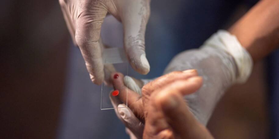 Ministério da Saúde lança tratamento inédito contra malária em crianças