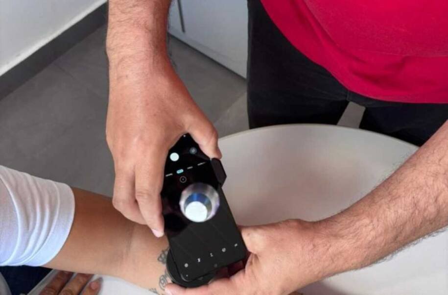 Telessaúde da UFSC revela 357 casos de câncer de pele em MS e gera alerta