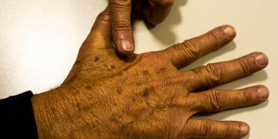 Fundação do Câncer alerta: 5.588 mortes em 2023 e falta de dados críticos