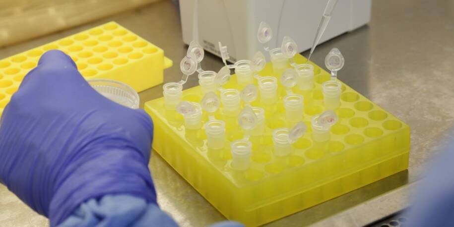 São Paulo confirma segundo caso importado de sarampo em 2026 e gera preocupação