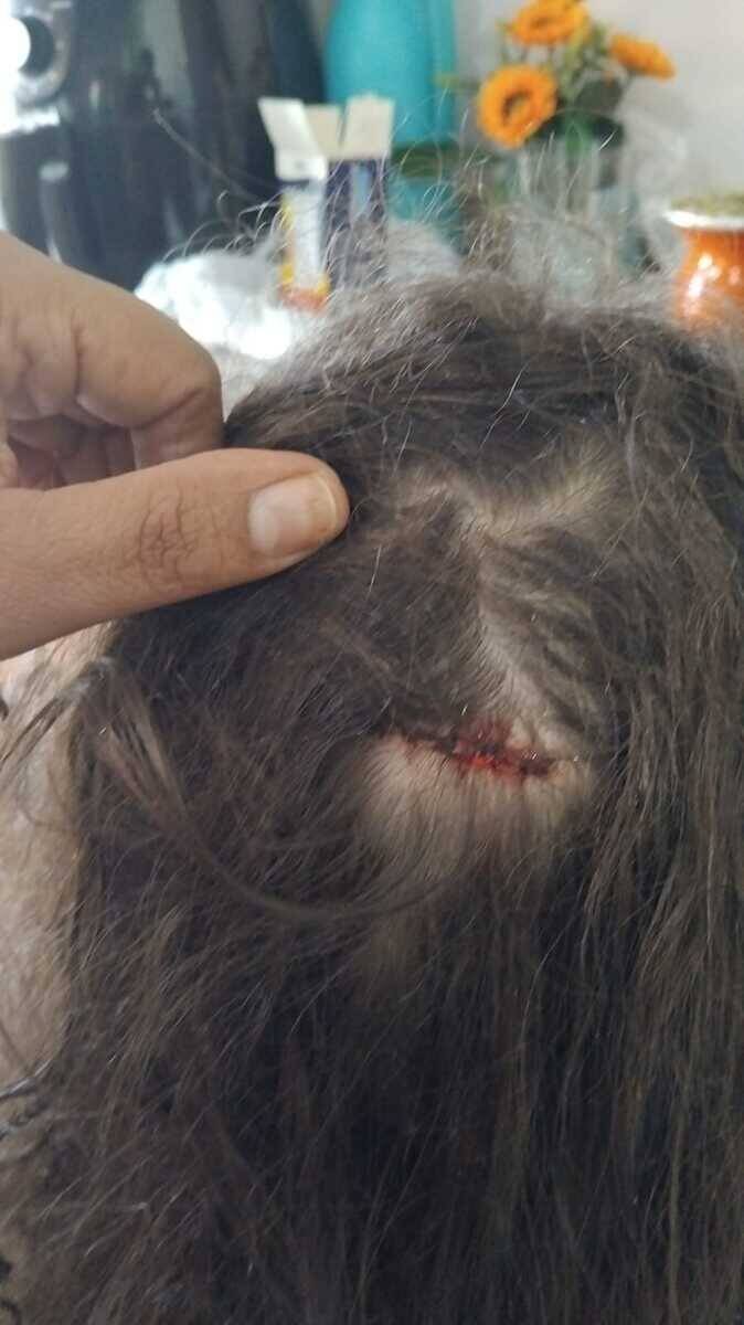 Campo Grande: Criança de 7 anos é atingida por bala perdida enquanto dormia