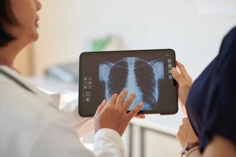 Anvisa libera Tyvaso, novo tratamento para hipertensão pulmonar e suas consequências