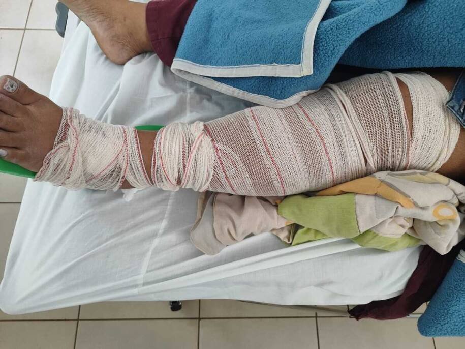 Naura Fausta da Silva é atropelada e assaltada em Campo Grande; motocicleta ainda não foi encontrada