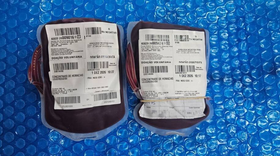 HEMOSC recebe bolsas de sangue raro para paciente com anemia falciforme em SC