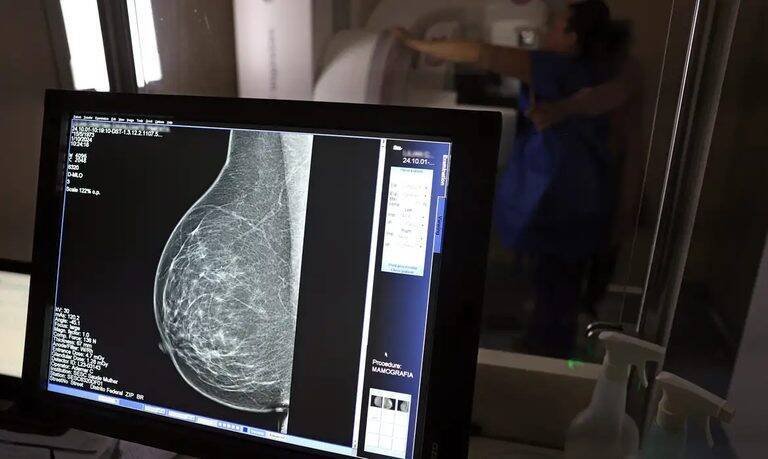 INCA revela disparidades alarmantes no câncer de mama entre mulheres negras