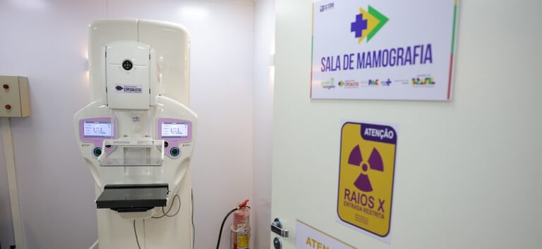 SUS registra 4,4 milhões de mamografias em 2025 e supera mastectomias
